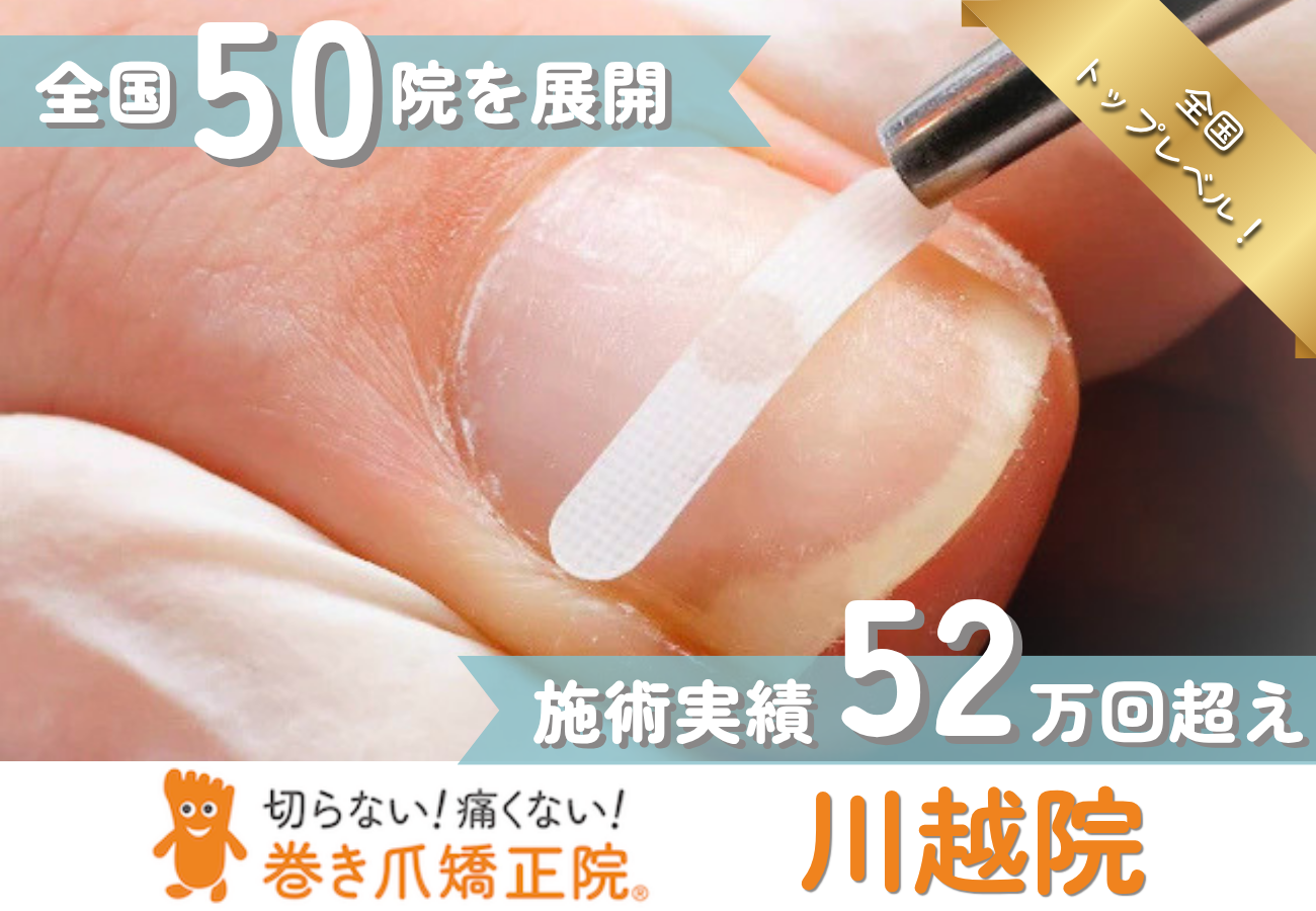 巻き爪　川越　全国トップレベル
