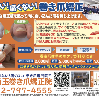 切らない!痛くない!巻き爪専門院 埼玉巻き爪矯正院のフライヤー