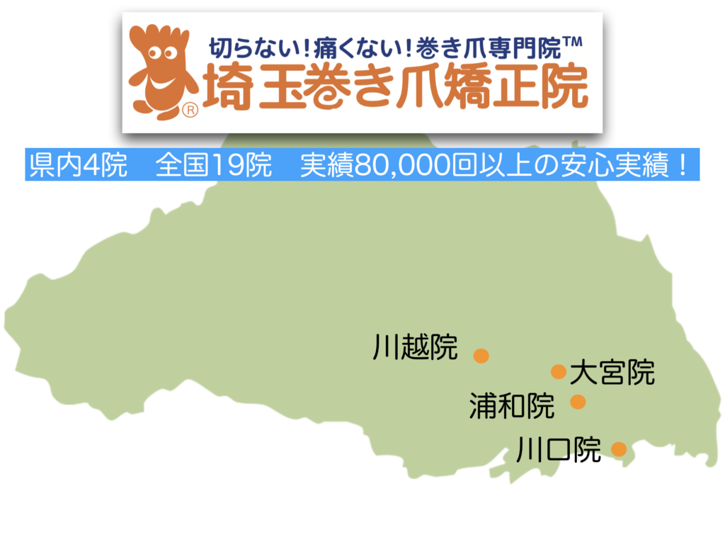 埼玉巻き爪矯正院 大宮院、浦和院、川口院、川越院