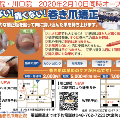 浦和区と川口市の巻き爪専門院オープンフライヤー