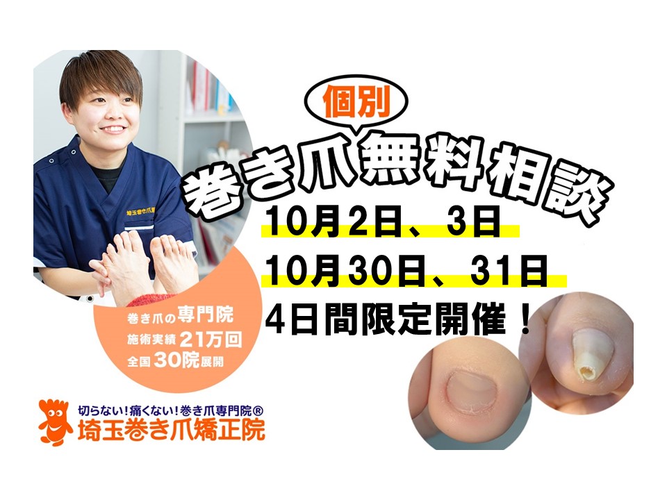 埼玉巻き爪矯正院2022年10月無料相談の案内
