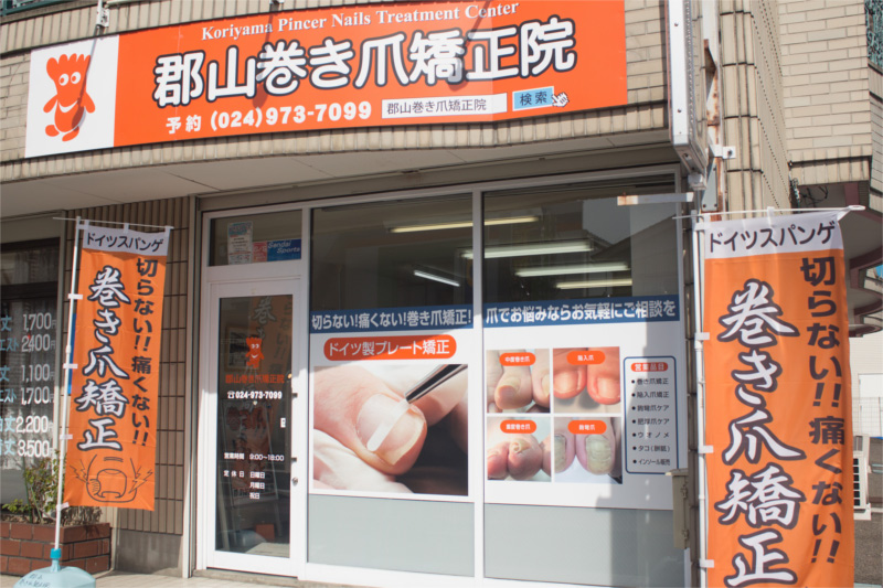 koriyama_Ingrown_nails_gaikan