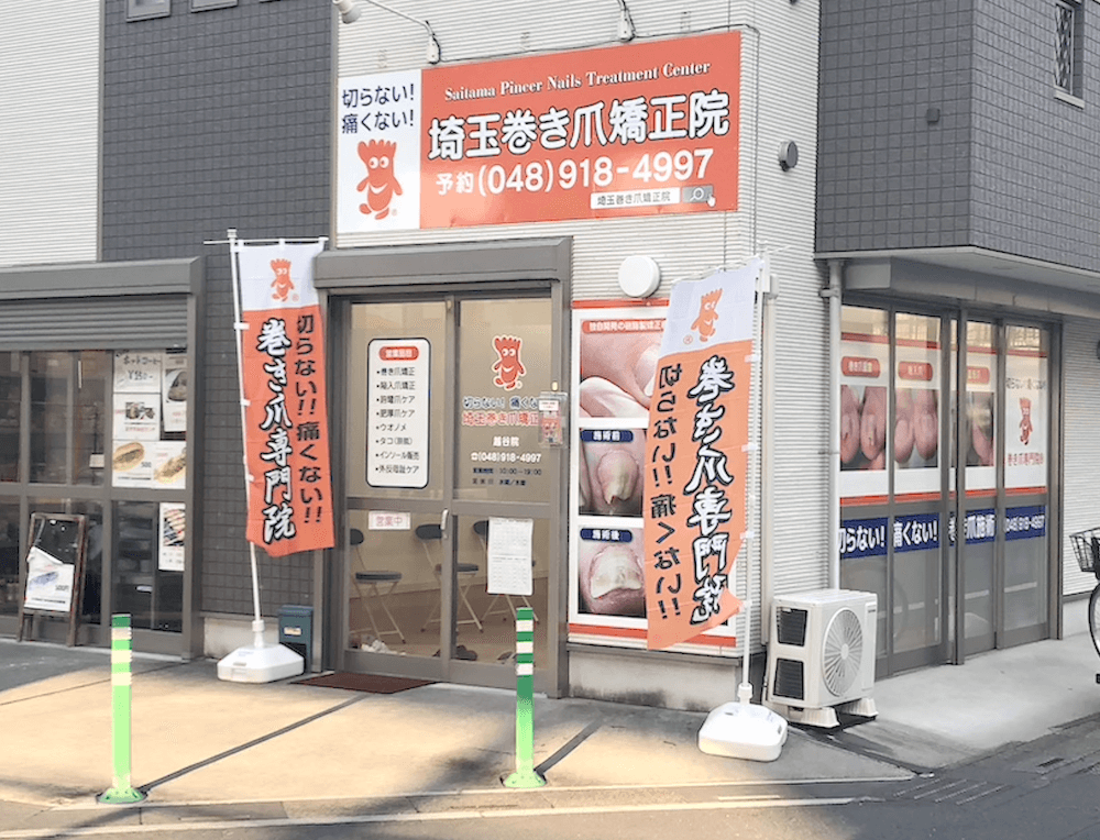 koshigaya ingrown nails treatmen center