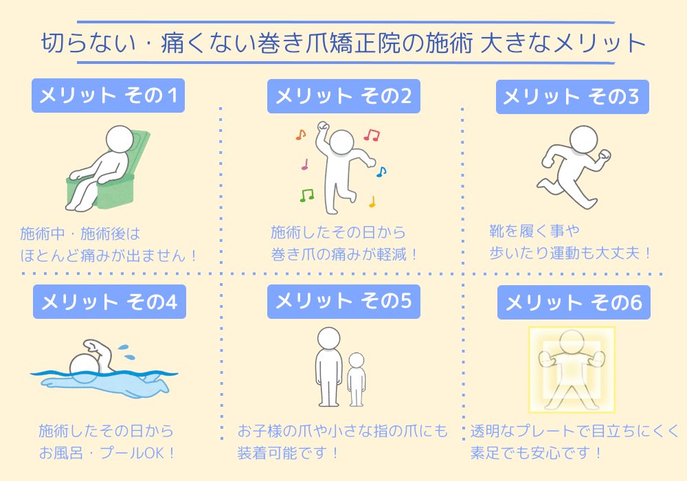 東京巻き爪矯正院の矯正方法のメリット説明画像